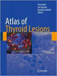   Thyroid Lesions, (1441960090), Arne Heilo, Textbooks   