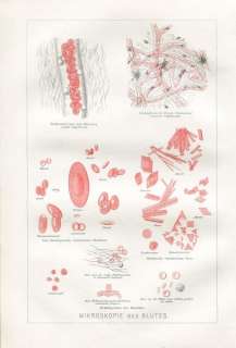 1887 BLOOD UNDER MICROSCOPE Antique Lithograph Print  