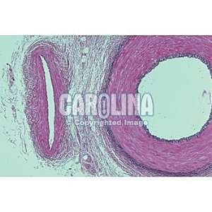  Human Aorta c.s. 7 m Verhoeffs stain, Microscope Slide 