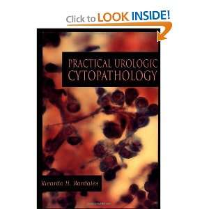  Practical Urologic Cytopathology [Hardcover] Ricardo H 