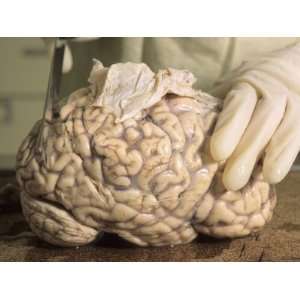  Hospital Morgue Preparing Brain for Autopsy Photographic 