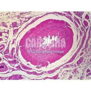  Human Ductus Deferens, c.s. Microscope Slide, 7 u 