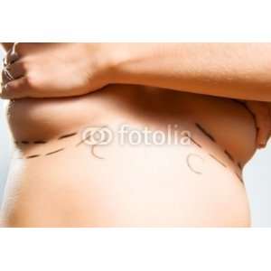   for Cosmetic Surgery   Removable Graphic 